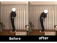 リリス(Lylis)/お客様ビフォー/アフター