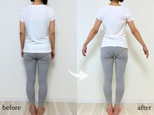 エーアール(AR)/【Before/After】6回目