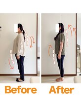 整体院ひなた 宮崎院/産後整体で肩こり骨盤改善!!宮崎