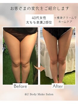 アンドユー(&U)/