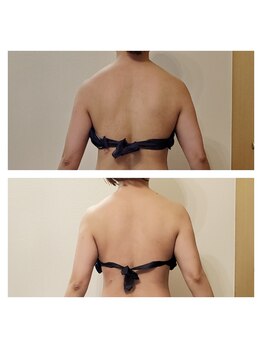 サロンドアクオン(salon de aqon)/お背中は本当に重要!!