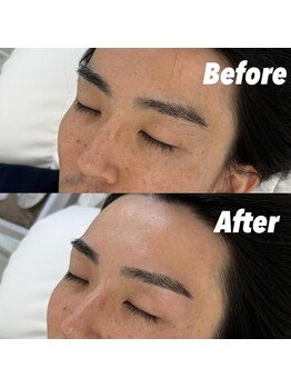 モテテ 池袋店(motete)/お客様施術例☆池袋 23