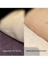 ラナクラニ/ビフォーアフター