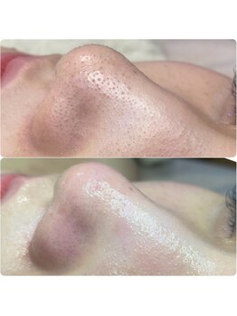 プアラ(puala)/ビフォーアフター