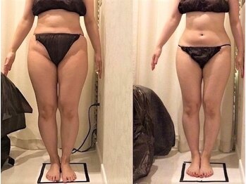 上野エステサロン レア(Lea)の写真/全身くまなく痩身&理想のBODYラインへ!短期集中でしっかり結果出し!強力5台痩身マシンかけ放題《女性専用》