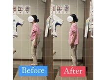 ナオル整体 宮崎院(NAORU整体)/60代女性施術事例【猫背姿勢】