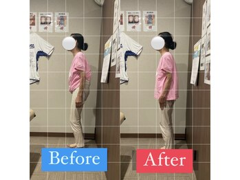 ナオル整体 宮崎院(NAORU整体)/60代女性施術事例【猫背姿勢】