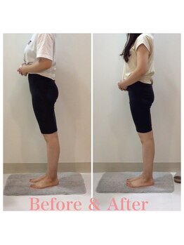 スタイルラボ高松/産後骨盤矯正の効果♪