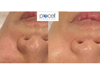 レイアップ(Leiup)