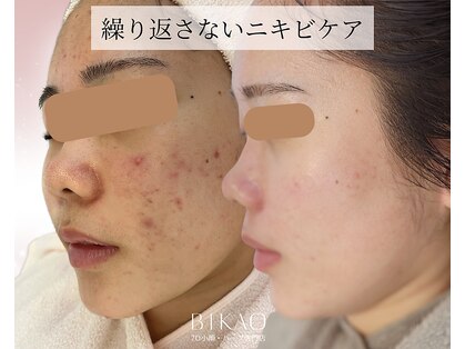 ビカオ(BIKAO)の写真