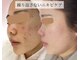 ビカオ(BIKAO)の写真