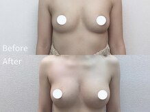 ウェルバスト 品川店(Well Bust)