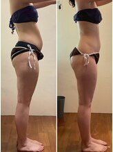 ニコワ(Nicowa)/Nicowaの痩身★BeforeAfter