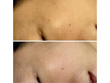 ジーナ(Ginna)の写真