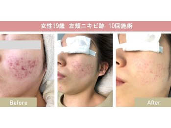 シャイン(SHINE)/