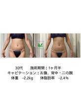 リシャイン(Reshine)/ブライダルダイエット