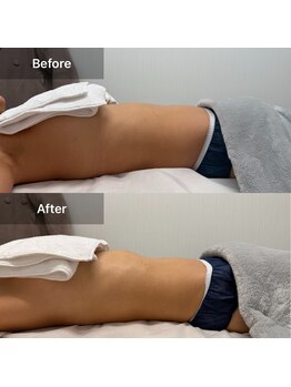 ルネアススパ 南青山(Lune’as Spa)/《WINBACK》お腹/内臓活性