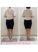 スタイルラボ高松/産後骨盤矯正の効果♪