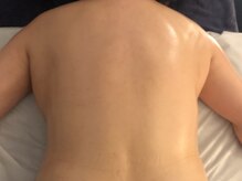 テールボーテ(Terre beaute)の雰囲気（背中のお肉も気になるけど、背中がとにかくツラいんです→→右へ）