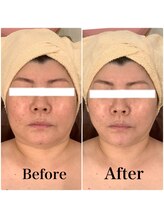 スペチアーレ 夙川/小顔と美肌が手に入る