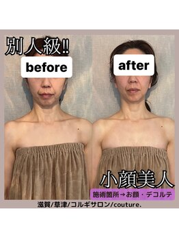 クチュール(couture.)/1回目after