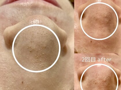 サニーシェルパ(32シェルパ)の写真