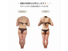 ビループ(biloop)/圧倒的な結果を。