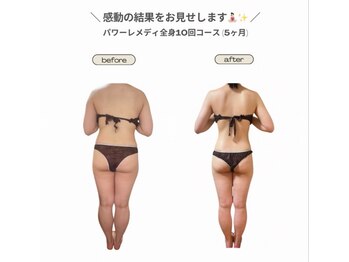 ビループ(biloop)/圧倒的な結果を。