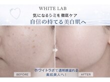 ヴィーナス 船橋駅前店(VENUS)/ホワイトラボ実例