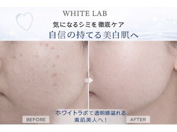 ヴィーナス 船橋駅前店(VENUS)/ホワイトラボ実例