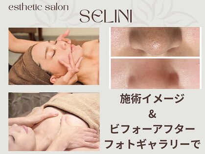 セリーニ(Selini)の写真