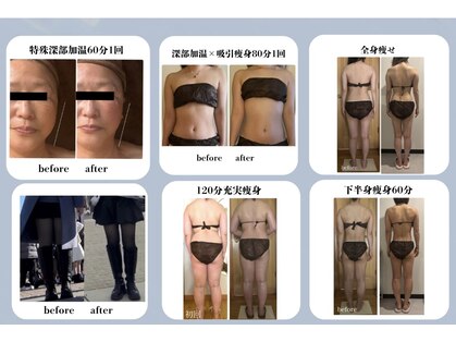 チャーム(Charm)の写真