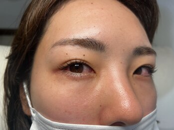 ジョリー(Jolie)/