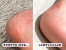 【かかとケア&フットネイル】