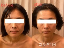 ビーキュート 神戸元町店(BE-CUTE)/コルギ1回