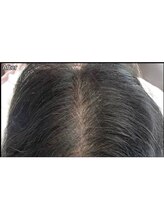 キュライム カブール町田店/頭頂部のボリュームアップが！