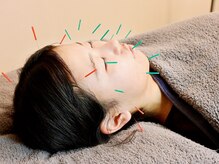 鍼灸マッサージここから/人気の美容鍼