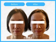 トウメイコガオ 横浜店/トウメイコガオ