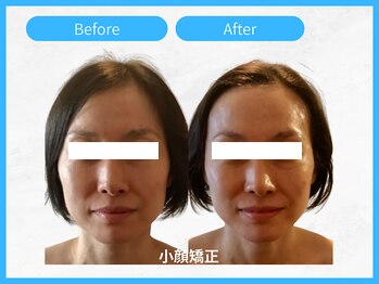 トウメイコガオ 横浜店/トウメイコガオ