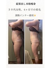 ムーン(MOON)/痩身4ヶ月の変化