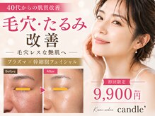 キャンドル(candle')