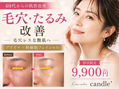 キャンドル(candle')の写真