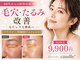 キャンドル(candle')の写真