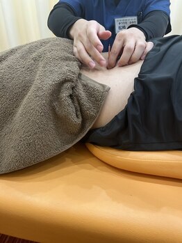逆瀬川やすらぎ接骨院 鍼灸院の写真/【深部のコリへ】頑固な疲れや慢性的なお悩みに！鍼灸による本格根本ケアで全身軽やか◎
