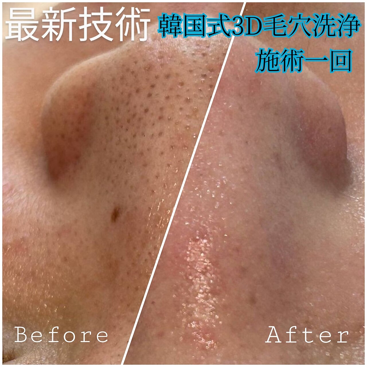 ホワイト アザブ(White Azabu)｜ホットペッパービューティー