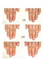 リンク(LINK)/クリア育成