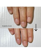 ホワイトネイル 武蔵小杉店(WHITE NAIL)/ネイルケア・自爪育成・爪育