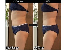 ヴァリ(VaRi)/ポッコリお腹解消　一回の効果