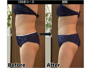 ヴァリ(VaRi)/ポッコリお腹解消　一回の効果