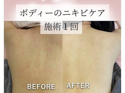 ビカオ(BIKAO)の写真